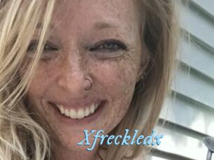 Xfreckledx